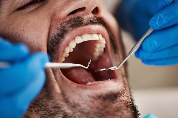 Emergency Dental Services in Green Valley, CA