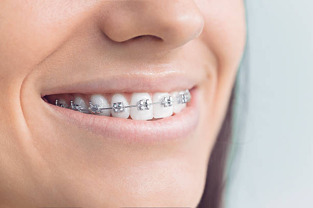 Best Veneers and Lumineers  in Green Valley, CA